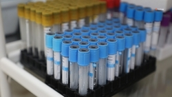 Министр здравоохранения Ставрополья: эпидемиологическая ситуация в крае не вызывает опасений