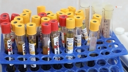 Уровень заболеваемости гриппом и ОРВИ на Ставрополье вырос на 9,4%