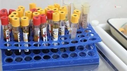 На Ставрополье показатель заболеваемости ВИЧ-инфекцией за год снизился на 4,6%