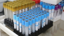 Вакцины от бешенства поступили в медучреждения Ставрополья