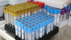 Более 400 ставропольцев побороли COVID-19 за неделю